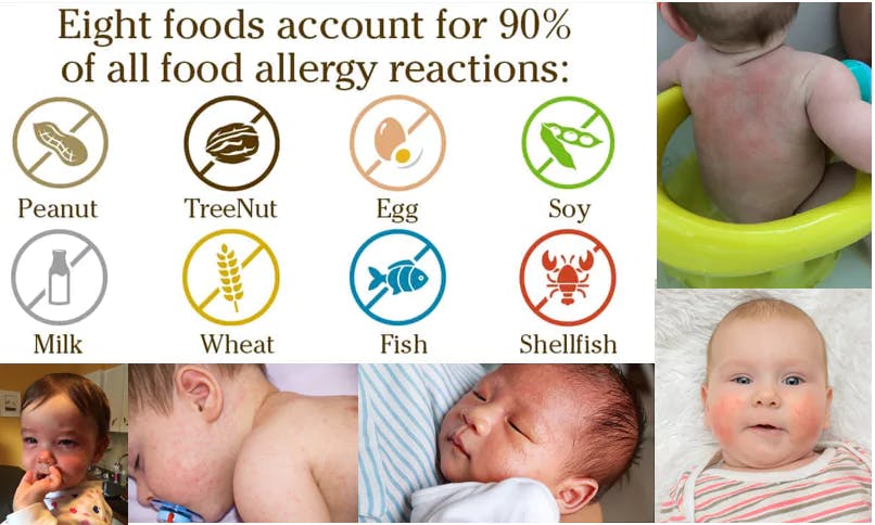 Baby Nutrition – How to Avoid Food Allergies