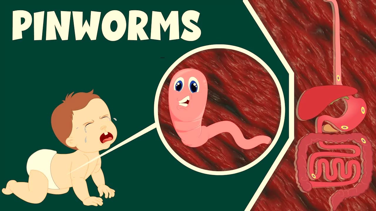 Learn about pinworms, a common parasitic infection in children, including their causes, symptoms, and treatment options. Discover ways to prevent pinworm infections through good hygiene practices. Join the Babynama community for expert advice on your child's health and development.