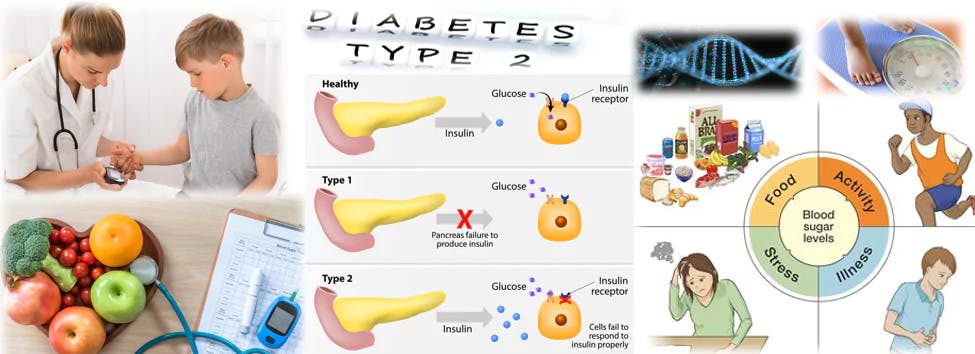 Type 2 diabetes in kids