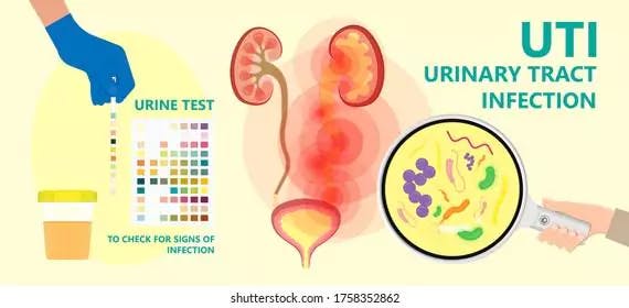 Urinary Tract Infections (UTI) In Kids
