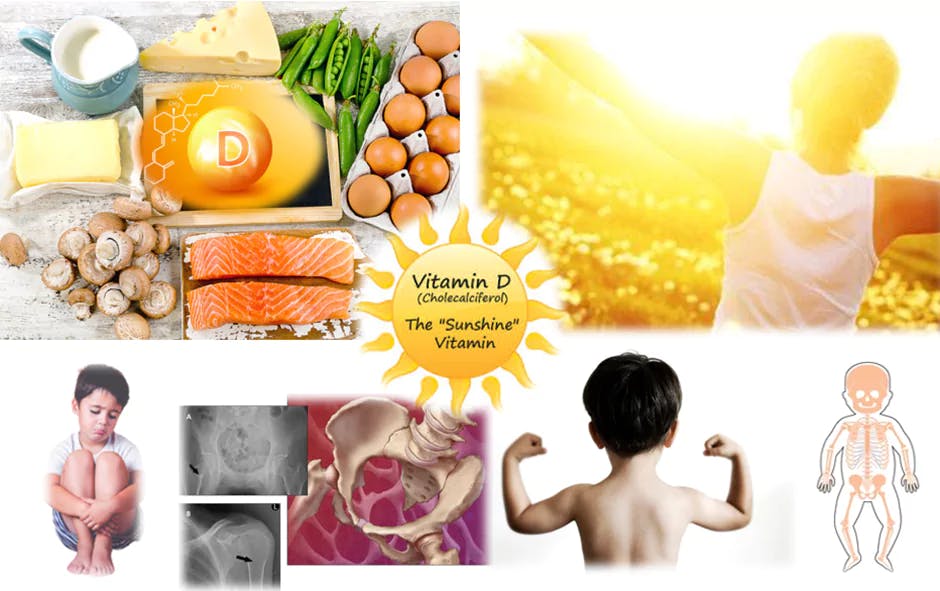 This blog provides essential information for parents on Vitamin D deficiency in children, its causes, symptoms, and prevention. It highlights the importance of Vitamin D for bone growth, development, and overall health. The blog covers various sources of Vitamin D, including sun exposure, food sources, and supplements. Parents can also learn about the children who are at higher risk of Vitamin D deficiency and how to ensure their child gets enough Vitamin D.