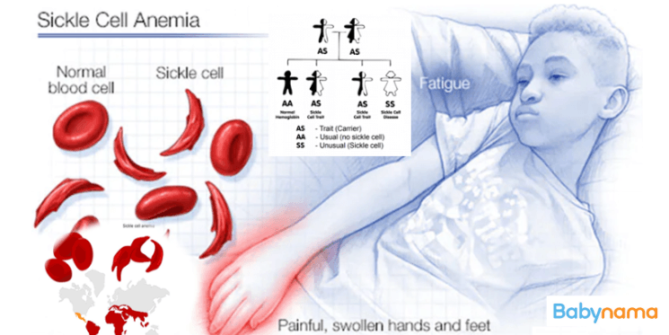 All About Pediatric Sickle Cell