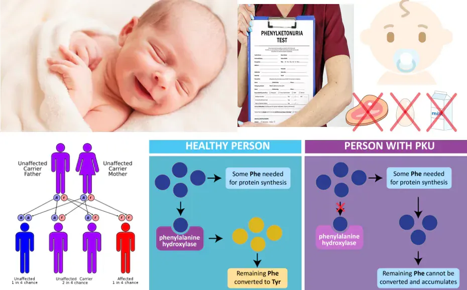 Phenylketonuria (PKU) Screening for a Newborn
