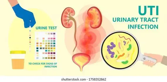 Pneumonia in Children: Warning Signs & When to Act