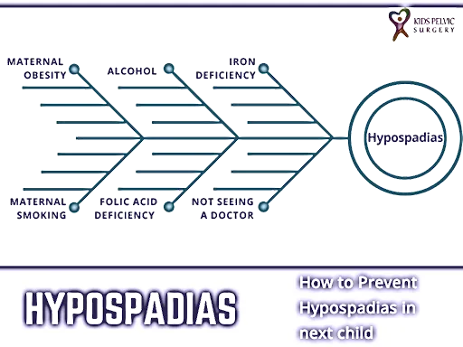 Hypospadias Prevention: Do's and Don'ts for Future Pregnancies