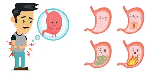 Gastritis in Children: Causes, Symptoms, and Treatment